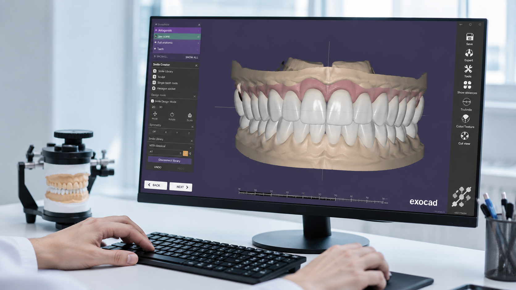 exocad 3D Digital Smile Design — Dr. Mervan Dental Clinic